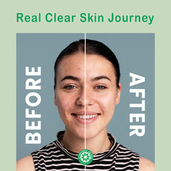 Ayurvedic Jeevan Black Detox Charcoal Soap for Face & Body